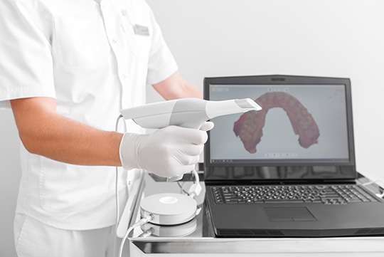 Intraoral scanner